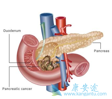 �������ٰ�