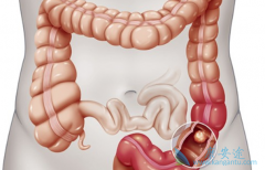 ����ֱ����֢״�����������ᱻ���ߺ���