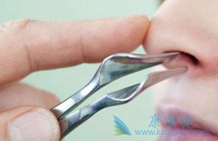 鼻咽癌症状 鼻咽癌症状