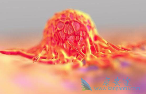 癌症晚期能活多久 癌症晚期能活多久