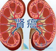 ��������(��������)������ʲô����Ч�����