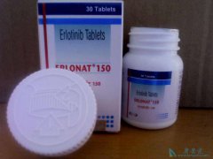 ӡ�����޿����������޿������Ʒ�����ʲô���