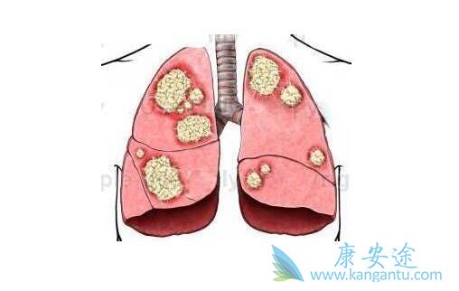 �ΰ��ᴫȾ��