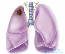 �ΰ���ת��֢״����Щ����ʲô�����������ƣ�