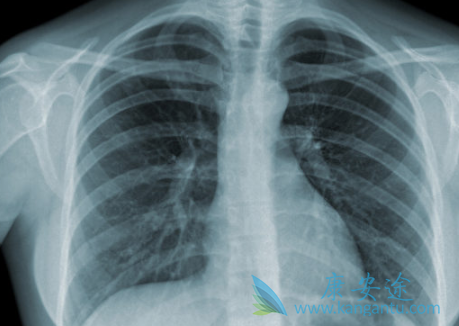 �ΰ�����֢״