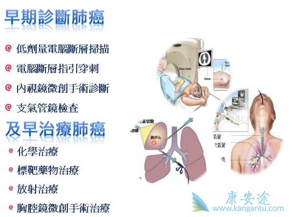 肺癌早期症状 肺癌早期症状