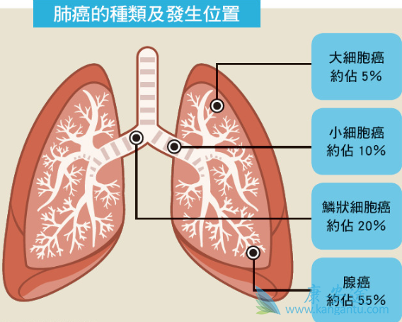 �ΰ������ܻ���