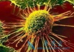 ���ǶȰ�(lenalidomide)/�����Ȱ�ά������DLBCLЧ����ô��