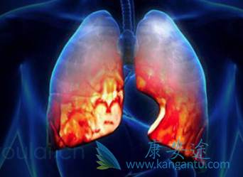 �ΰ������ܻ���