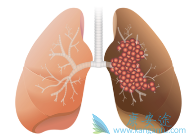 �ΰ����ڻ��ܻ���