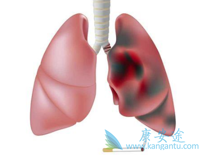 �ΰ�����֢״