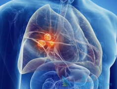 �����澱��ˮ�׵����Ƿΰ�����֢״