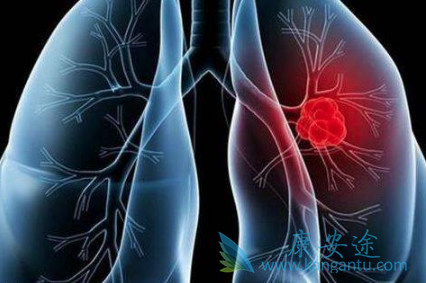 �ΰ����ڵ�֢״