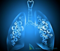 �ΰ����ڴ�Ⱦ�𣿷ΰ��γɵ�ԭ������Щ