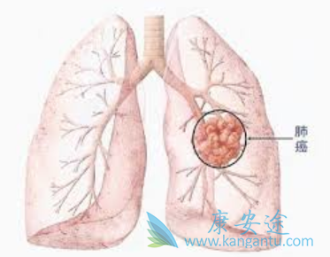 �ΰ����ڴ�Ⱦ��