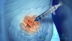 ��������/�����������ٰ�һ��Ԥ����ѡҩ����