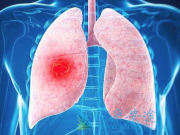 �ΰ�������ô����