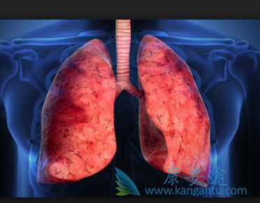 �ΰ�������ô����