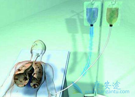 �ΰ������ܻ��