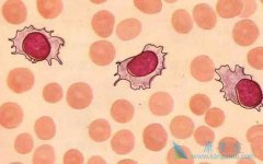 �������θ����ļ���B�ܰ�ϸ����Ѫ���ķ�������Щ