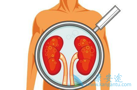 卡博替尼 卡博替尼