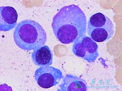 ��������(Cabozantinib)���ƶ෢�Թ�����������Ӧ�϶�