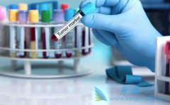 ���ΰ���������ƫ�������Ч����