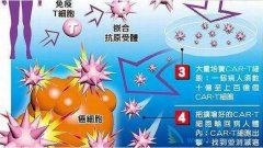 Car-T����ʵ���������̱�ʽͻ�� NBT