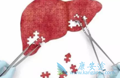 丙肝传染吗 丙肝传染吗