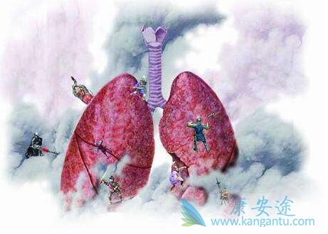 非小细胞肺癌 非小细胞肺癌