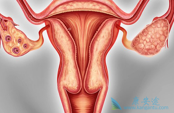 奥拉帕尼 奥拉帕尼