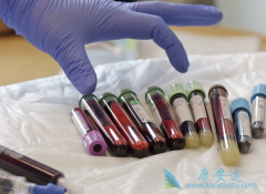 CARTϸ�����Ʒ����ĸ�������������֢�Ʒ�һ�����ݺ���