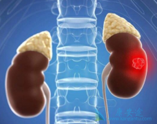 ��������һ�����Ƴ���ѡ���������ỹ�б��ҩ����