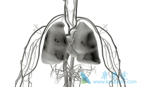 肺癌能治好吗 肺癌能治好吗