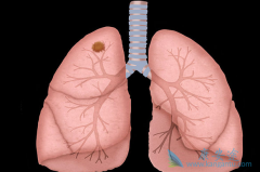 �ΰ�������֢״����Щ�������������Ԥ���ΰ�������