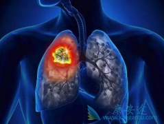 ��ҽ���Ʒΰ����������Ʒΰ���ƫ������Щ��