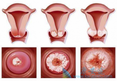 ����ǰ������֢״����Щ�����������Ԥ����֢��