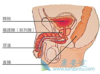前列腺癌症状 前列腺癌症状