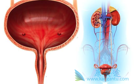 膀胱癌症状 膀胱癌症状