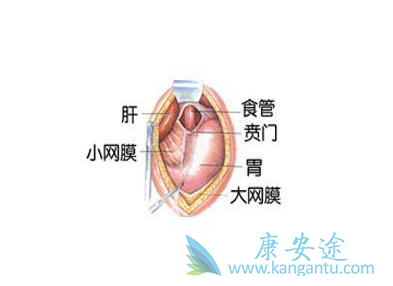 贲门癌症状 贲门癌症状