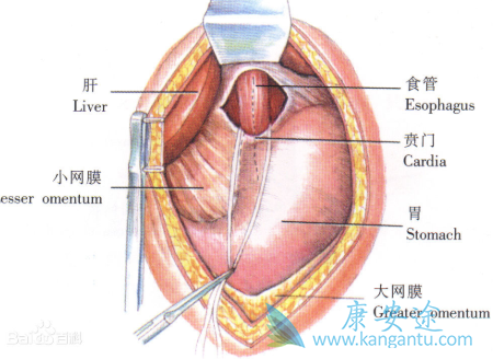 贲门癌症状 贲门癌症状
