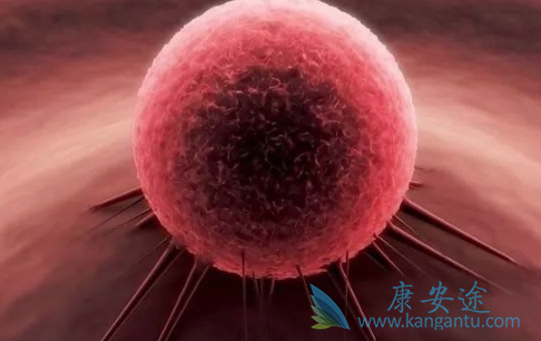 癌症复发 癌症复发