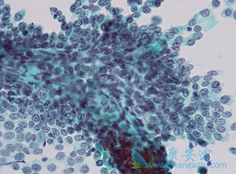 雷莫卢单抗 雷莫卢单抗