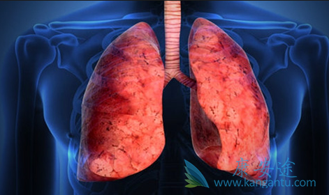 雷莫芦单抗 雷莫芦单抗
