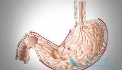 θ��D2��������ʹ�ð�ɳ����(Eloxatin)����������Ч����