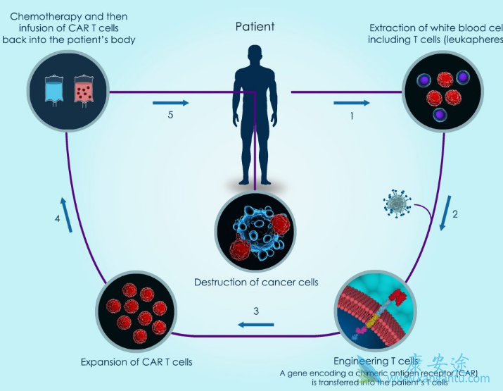 CAR-T细胞治疗 CAR-T细胞治疗