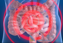 FCGR2A�������жϳ�������ʹ�ð�����/�����������Ƿ���Ч������