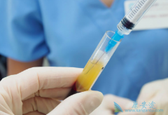 ��άĪ˾(EVERTOR)����������ؼ�����������ֲ����һ������Ĥ����