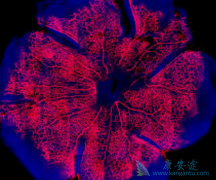 �����׷�(toremifene)��ô���ã���ʲô�����ã�