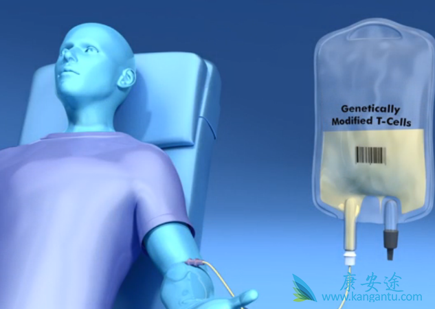 CAR-T免疫疗法 CAR-T免疫疗法